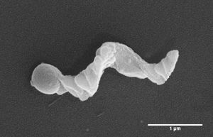 나선형 나노모터의 주사 전자 현미경 이미지