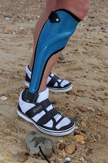 맞춤형 발 보조기는 단기적인 통증 완화를 제공할 수 있다.