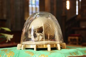 프라하에 있는 성 아달베르트의 두개골