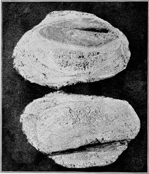 화살촉에서 생성된 결석