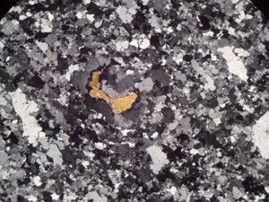 그래뉼라이트 현미경 사진