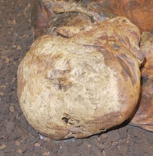 린도 맨의 머리 윗부분. V자형 절단면이 중앙 하단에서 보인다.