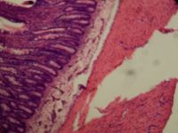 장 상피 (H&E 염색)