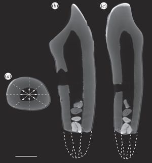 유인원과 비교한 이빨 뿌리(a), 에나멜 손실(b & c), 손상되지 않은 뿌리가 어떻게 보일지 나타내는 점선(b & c)을 보여주는 필트다운인의 송곳니 3차원 CT 스캔