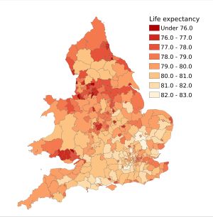 2012–2014년 잉글랜드와 웨일스 지역 자치구별 남자 출생 시 기대 수명.