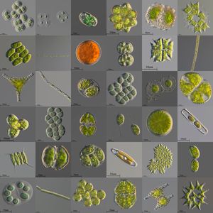 다양한 단세포 및 식민지 담수 미세 조류