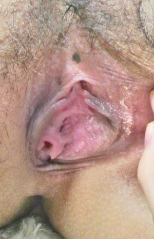 여성기의 치구 (열람 주의)