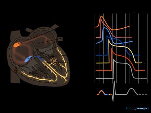 심장의 다양한 부분에서 나타나는 심장 활동 전위의 모양.