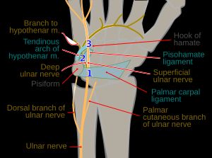 손에서의 자신경 가지
