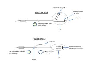 OTW 대 Rx 풍선 카테터의 해부학