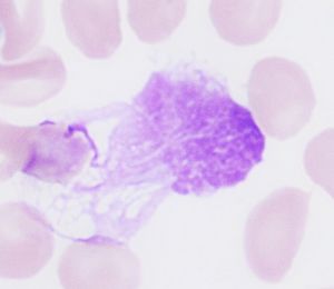 핵영(스머지 세포)