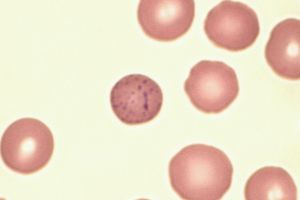 호염기성 반점 적혈구