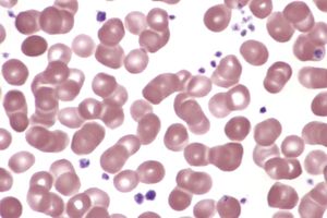 적혈구와 혈소판