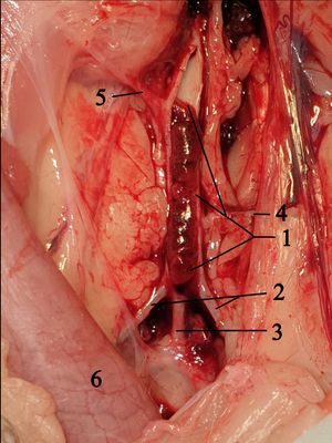 고양이 대동맥의 안장 혈전. 1 열린 대동맥(Aorta)과 혈전, 2 바깥 엉덩동맥(A. iliaca externa), 3 두 개의 속엉덩동맥(Aa. iliacae internae)의 공통 줄기, 4 깊은 엉덩휘돌이동맥(A. circumflexa ilium profunda), 5 아래창자간막동맥(A. mesenterica caudalis), 6 내림창자(Colon descendens).