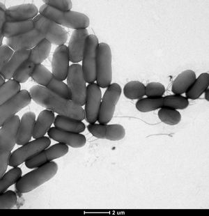접합 F-필리의 네트워크를 사용하여 광범위한 생물막을 형성하는 세균 Escherichia coli을 보여주는 투과 전자 현미경 사진