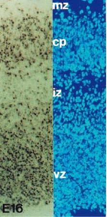 증식 구역에서 죽어가는 세포