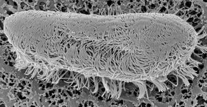 주사 전자 현미경 이미지 Ichthyophthirius multifiliis의 테론트 (사진: Ole S. Møller, 코펜하겐 대학교)