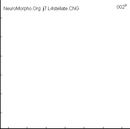 간의 별세포(이토세포)