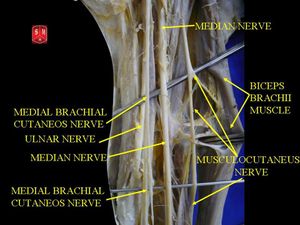 깊은 곳 해부로 드러난 근육피부신경.