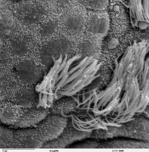 섬모와 비섬모 기관지 상피의 훨씬 작은 미세융모