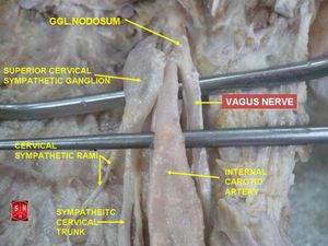 속목동맥 - 해부