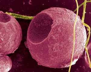 세포 위의 황화 카드뮴 양자점