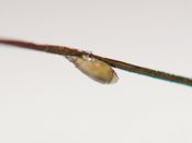 인체 털에 있는 사면발니 알