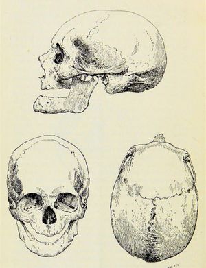찰스 윌리엄스의 《토머스 브라운 경의 두개골 측정》(1895)에 삽화로 실린 브라운의 두개골