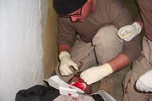 찰스 A. 그래너가 결박된 구금자의 턱에 봉합사를 적용한다.