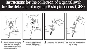 GBS 검출을 위한 생식기 면봉 채취 지침