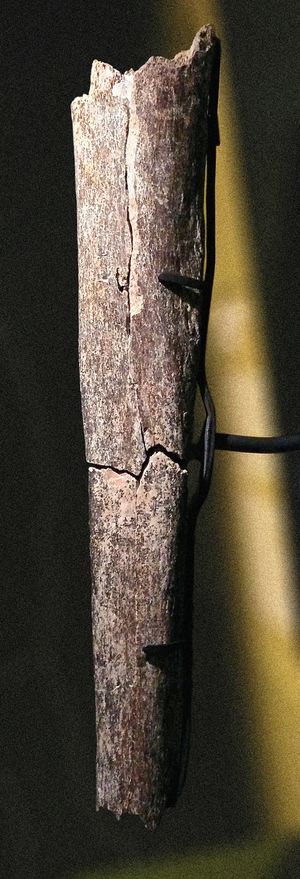 박스그로브의 남자}}의 경골