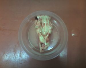 BSE 검사를 위한 후두부