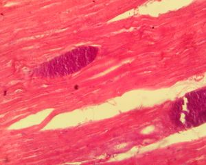 3세 양 심장 근육 조직에서 근육포자충을 보여주는 H&E 현미경 사진(40X)