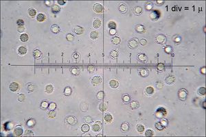 포자는 반투명하고 사마귀 모양이다.