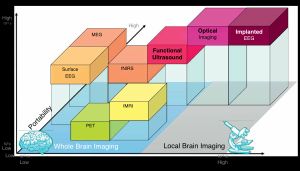 주요 뇌 기능 영상 기술 해상도