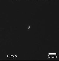 성장하는 대장균 집락