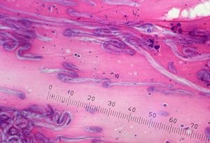 구마노나다에서 얻은 참갑오징어 Sepia (Doratosepion) tenuipes의 신장낭에 기생하던 니하이추류의 미기재종 Dicyema sp.