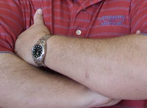 왼쪽 팔의 작은 반점이 메르켈 세포 암종이다.