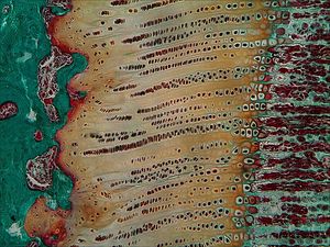 토끼 뼈끝판의 Masson Goldner 삼색 염색. 각 구역의 세포 배열을 보여준다.