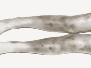 심각한 타박상, 영양실조 및 흉터의 징후를 보이는 자렐리의 다리