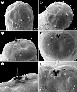 필로메트라 셀라리스}} (선충, 필로메트리과), 큰 눈자리돔의 난소 기생충. SEM.