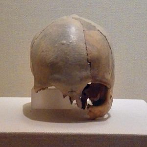 아투스 사람 두개골, 아르구 마을, 아투스에서 발굴, 기원전 10,000년 경으로 추정