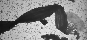 마리프로푼두스 페로옥시단스 PV-1 세포가 꼬인 자루에 부착된 TEM 이미지.