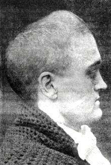 두개골 뼈의 비정상적인 융합은 크루존 증후군의 특징입니다.