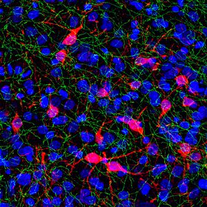 붉은색의 티로신 수산화 효소와 녹색의 세로토닌 수송체 (Slc6a4), 푸른색의 핵 DNA를 쥐 뇌간에서 보여준다. EnCor Biotechnology Inc.의 항체 염색 및 이미징