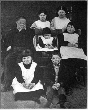 선천아이오딘결핍증후군을 앓고 있는 다양한 연령대의 남녀 환자 그룹