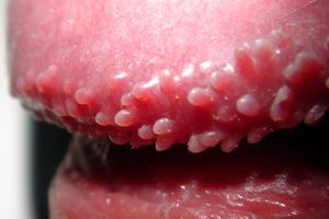 진주양음경구진 근접 이미지