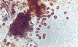 붉은 비에 포함된 입자의 광학 현미경 사진