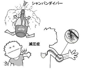 감압병 발병 원리 도해