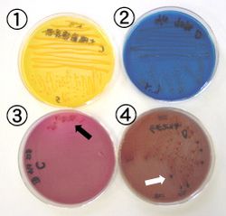 살모넬라(오른쪽, 2와 4)와 대장균(왼쪽, 1과 3)의 감별. (상단) 유당 분해 지시약이 포함된 배지(BTB 배지)에서 배양하면, 유당을 분해하는 대장균(1)은 배지가 황변하고, 분해하지 않는 살모넬라(2)는 배지는 청색이 된다. (하단) 담즙산과 황화수소 지시약이 포함된 배지(SSB 배지)에서 배양하면, 담즙산 감수성인 대장균은 발육 저해되어 콜로니 수가 감소하지만(3, 검은 화살표), 담즙산 내성인 살모넬라는 정상적으로 발육하고, 또한 황화수소 생성에 의해 콜로니에 흑변이 관찰된다(4, 흰 화살표)